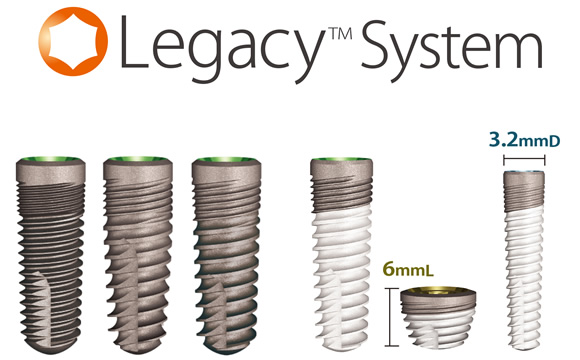 Legacy（レガシー）シリーズインプラント