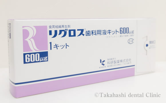 リグロス